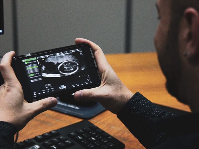 São Cristóvão Saúde adere a tecnologia do Ultrassom gestacional 3D mobile