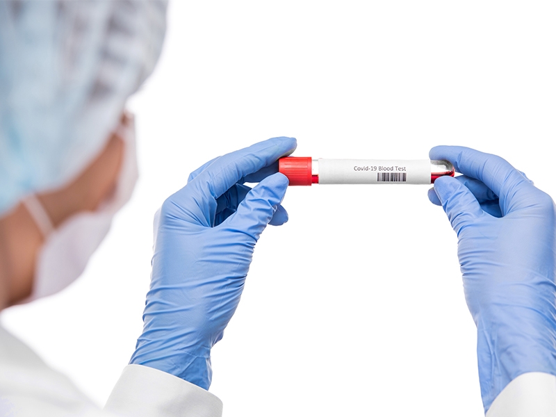 ANS inclui exame para detecção de Coronavírus no Rol de Procedimentos obrigatórios