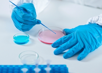 Todos os laboratórios públicos do país podem realizar exame para coronavírus