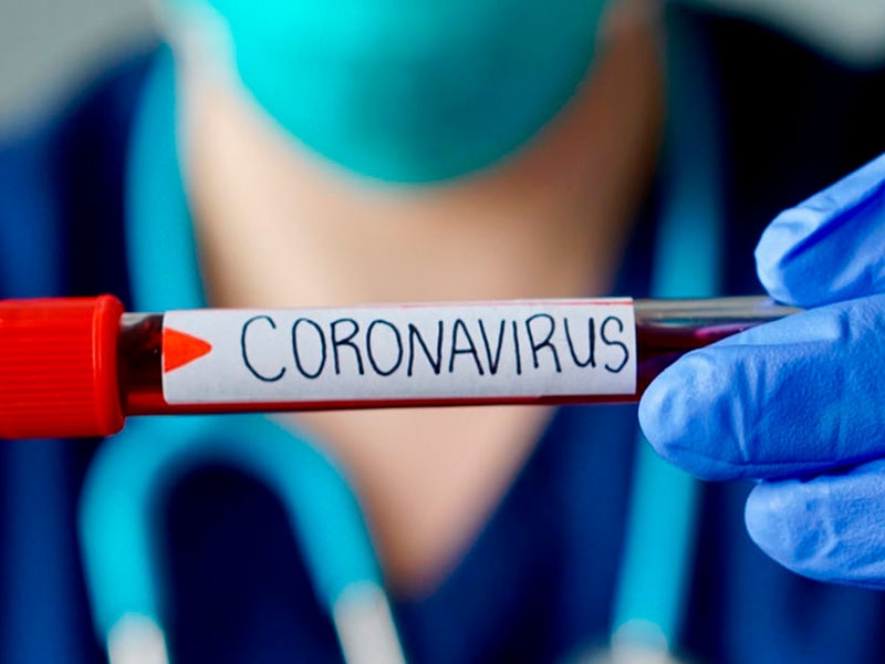 LAIS exporta tecnologia para o enfrentamento à pandemia