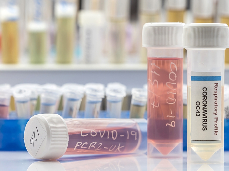 Instituições beneficentes indicadas por empresas receberão o Medteste Coronavírus