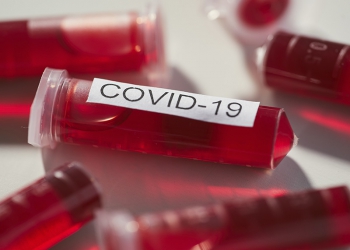 A pandemia vai trazer evolução histórica para a saúde global, por José Márcio Cerqueira Gomes