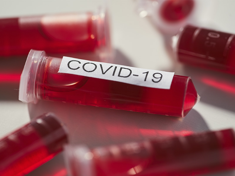 A pandemia vai trazer evolução histórica para a saúde global, por José Márcio Cerqueira Gomes