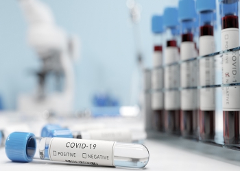 Com mais de 10,2 milhões de testes de COVID-19 em 2020, setor privado foi responsável por 43,1% de todo o diagnóstico do país