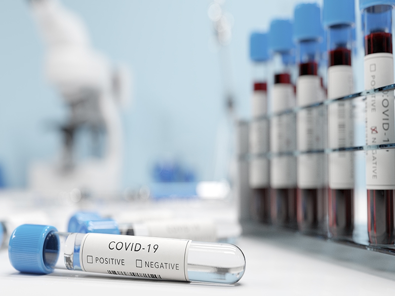 Com mais de 10,2 milhões de testes de COVID-19 em 2020, setor privado foi responsável por 43,1% de todo o diagnóstico do país