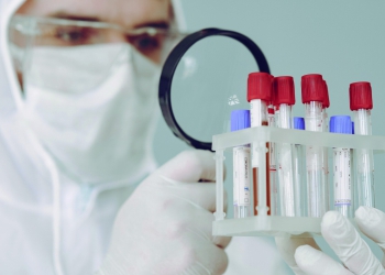 Combinação de RT-PCR e exames sorológicos de anticorpos tipo ELISA é a melhor forma de diagnóstico para a Covid-19