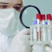 Combinação de RT-PCR e exames sorológicos de anticorpos tipo ELISA é a melhor forma de diagnóstico para a Covid-19
