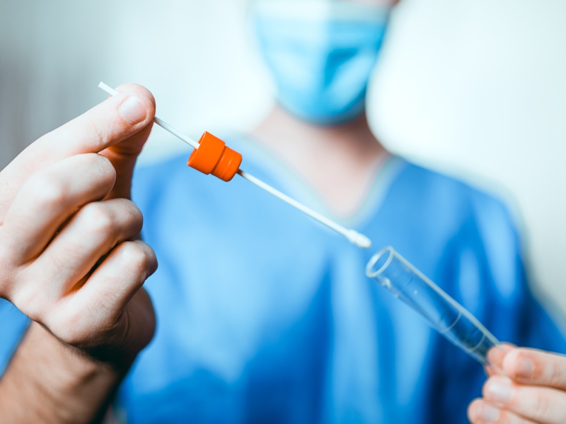 Empresa doa mais de 20 mil testes rápidos de Covid para Secretarias Públicas de Saúde