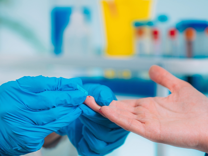 Chega ao Brasil primeiro teste rápido para detectar anticorpos específicos contra a Covid-19