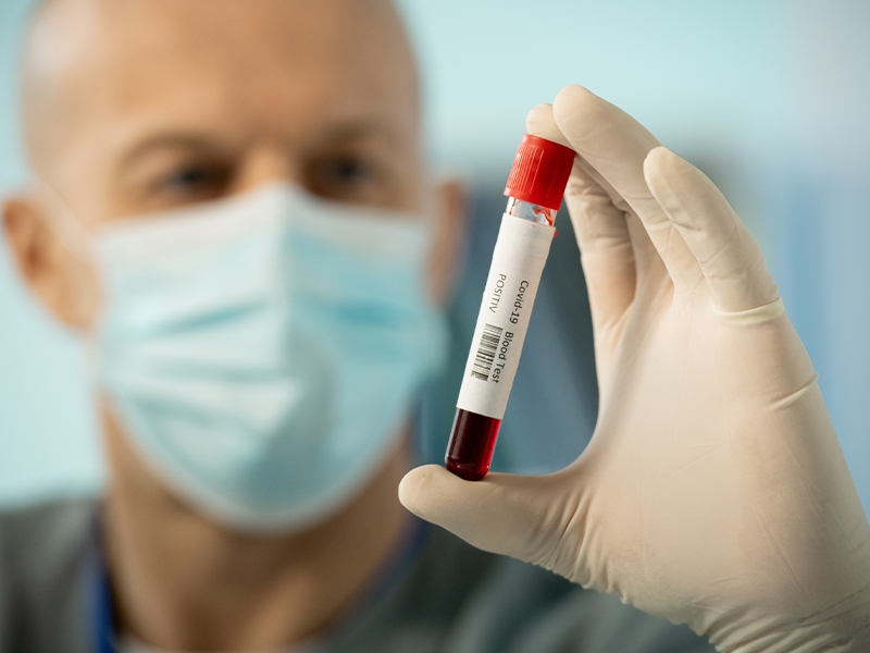 InCor participa de investigação genética sobre casos graves da Covid-19