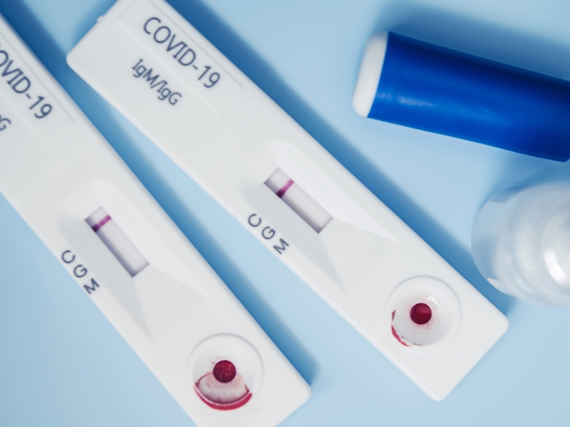 ANS aprova inclusão de teste rápido para diagnóstico da Covid-19 no rol de coberturas obrigatórias