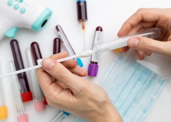 Laboratórios alertam para ameaça de desabastecimento de insumos para testes de Covid-19