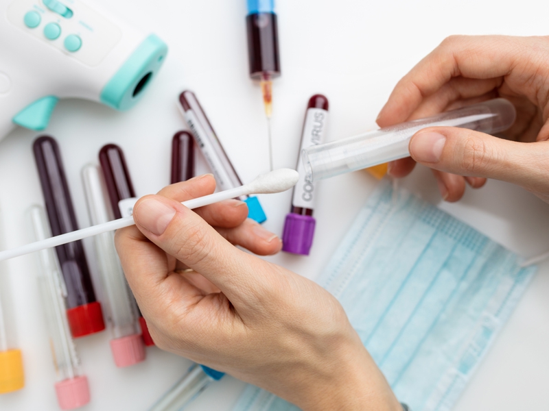 Laboratórios alertam para ameaça de desabastecimento de insumos para testes de Covid-19