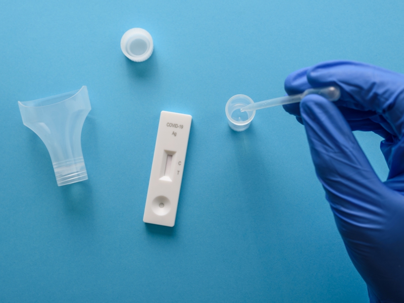 Total de exames para Covid-19 em laboratórios cai 28% na primeira semana de fevereiro