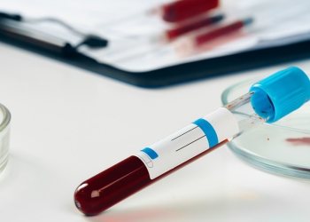 Sabin recebe certificação internacional para exame de hemoglobina glicada