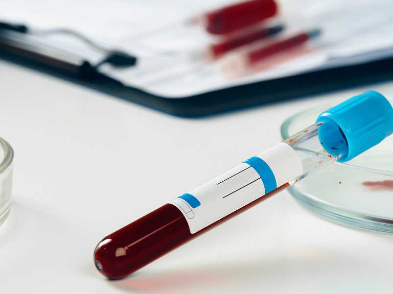 Sabin recebe certificação internacional para exame de hemoglobina glicada