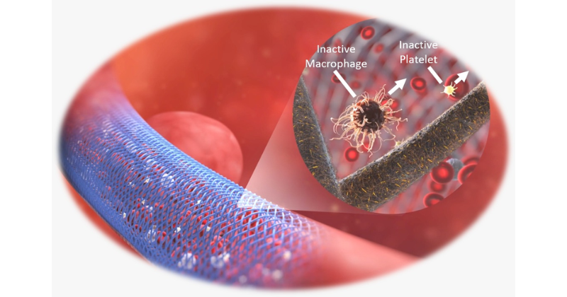 Hospital das Clínicas de Ribeirão Preto inicia uso pioneiro de novo dispositivo para tratamento de aneurismas cerebrais
