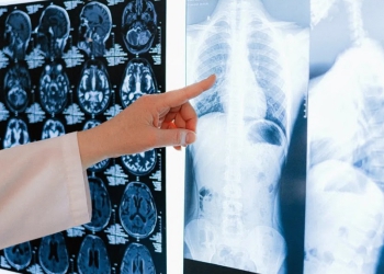 Oncoclínicas e Casa de Saúde São José lançam programa de cuidados para nódulos pulmonares
