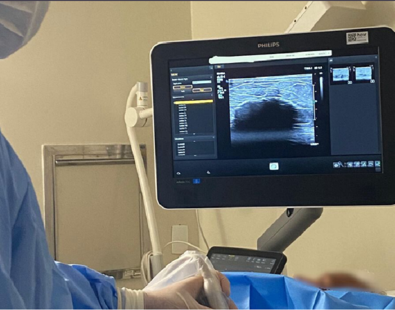 Um passo histórico no tratamento do câncer de mama