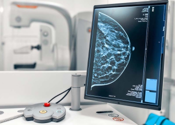 SPR lança desafio de IA para diagnóstico de mama