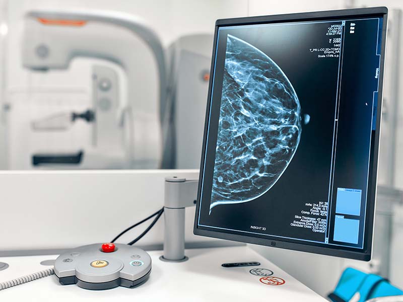 SPR lança desafio de IA para diagnóstico de mama